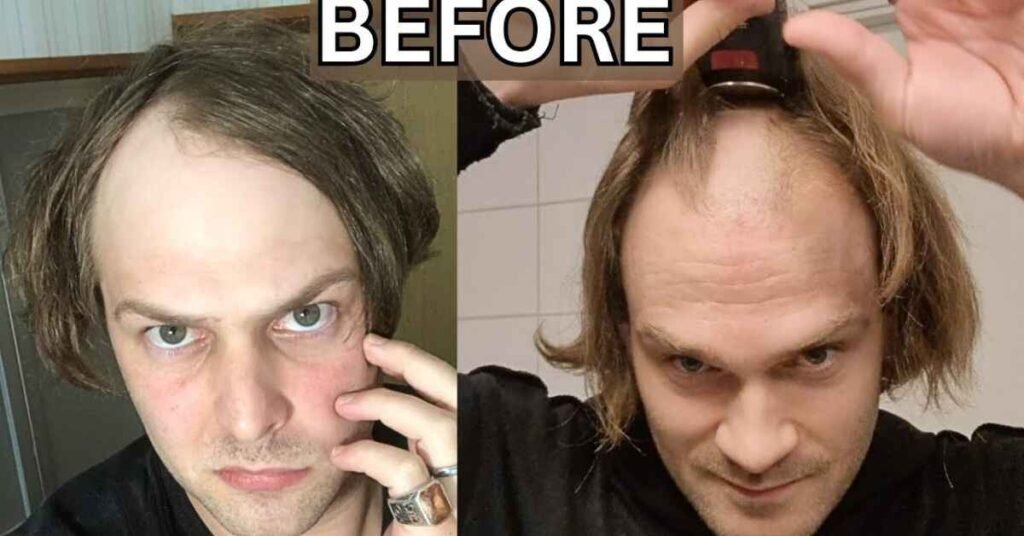 Haircuts for Balding Crown 